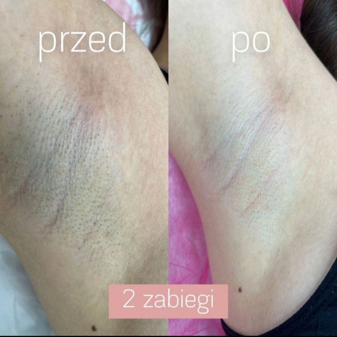 Realizacja 28