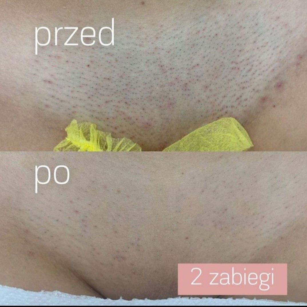 Realizacja 29